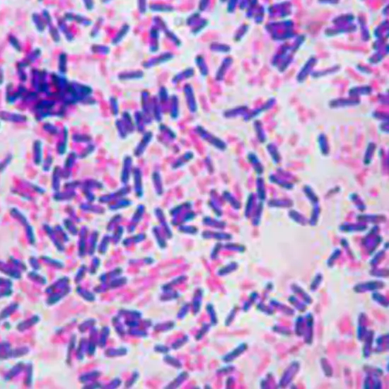 Gram Stain Bacteria